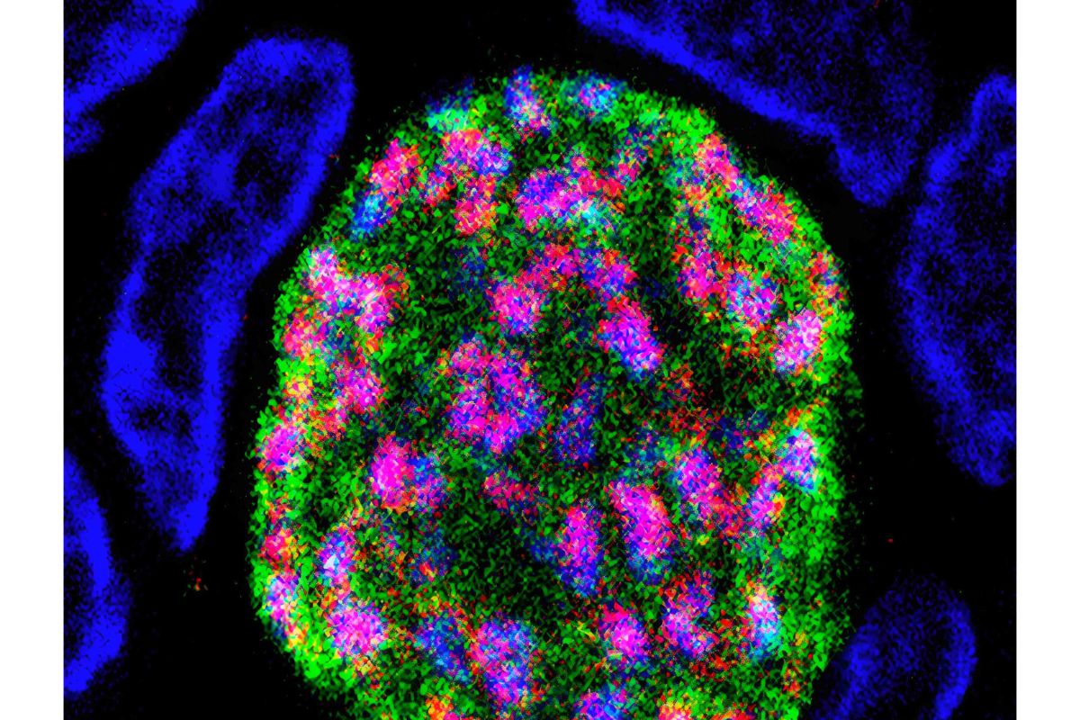 MSphere written at top then colorful blob below